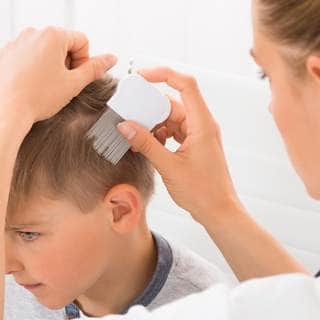 إذا كنت تشك في وجود قمل الرأس