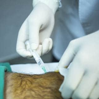 تشخيص النقرس