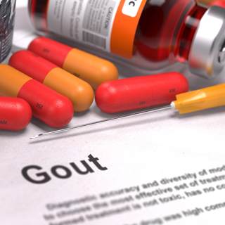علاج النقرس بالأدوية