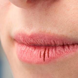 كيف تشعر عند إصابتك بالجفاف؟