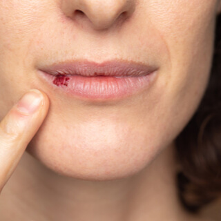 كيف يُؤثر جفاف الفم على صحتك؟