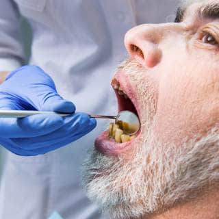 6. إهمال الأسنان