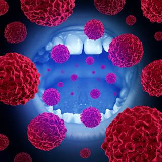 6. سرطان الفم