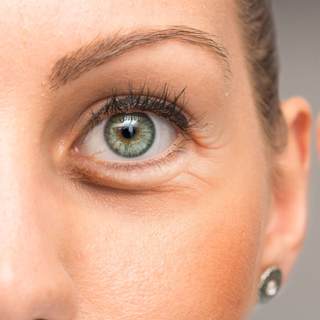 التخلص من الانتفاخ تحت العين