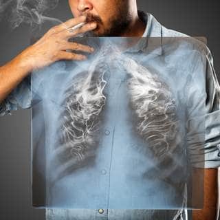 السبب الرئيس: التدخين السبب الرئيس: التدخين