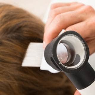 علاج تساقط الشعر