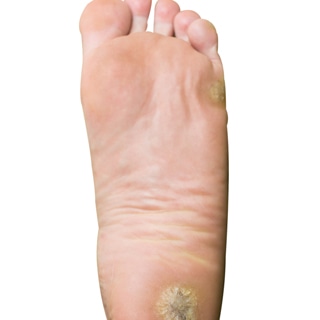 5. مشاكل القدمين