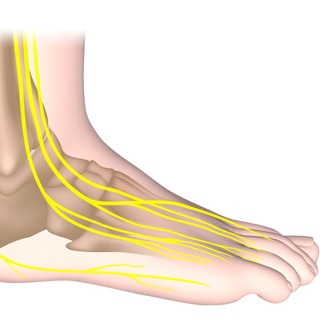 4. تلف الأعصاب 4. تلف الأعصاب