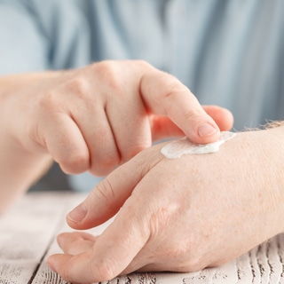 2. جفاف اليدين