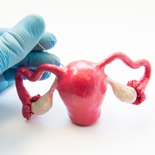 ما هي بطانة الرحم