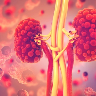 4. مرض الكلى المتعدد الكيسات