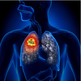 6. تقي من السرطان