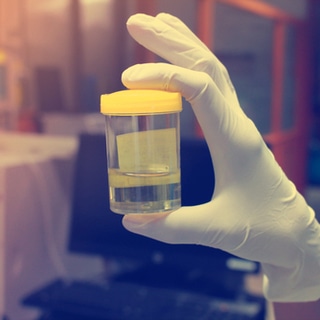 4. يحفز تدفق البول