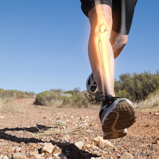 5. يزيد من كثافة العظام وقوة المفاصل