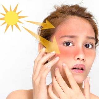 4. ضربة الشمس