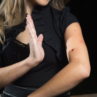 5. لدغات البعوض