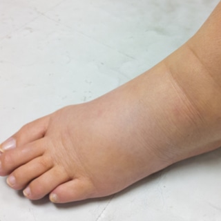 3. الاستسقاء