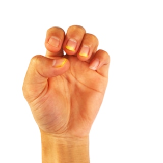 الأظافر الصفراء