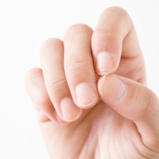 أظافر هشة وتتشقق 