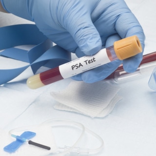 اختبارات لسرطان البروستاتا