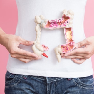 سرطان القولون والمستقيم