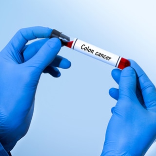 اختبارات سرطان القولون