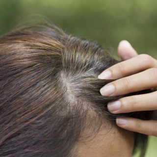 الشعر الأبيض