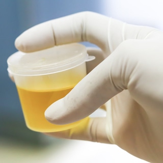 رائحة الأمونيا رائحة الأمونيا