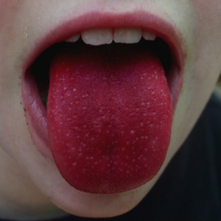 اللسان الأحمر الساطع