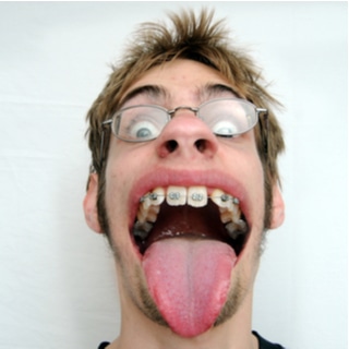 ضخامة اللسان