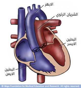 تبديل الشرايين الكبرى