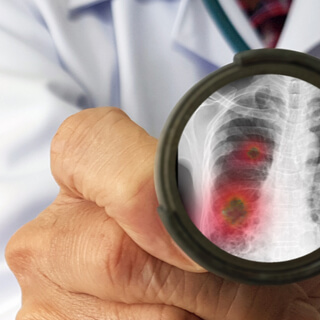 خطر الإصابة بفيروس كورونا الجديد