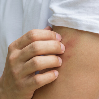 فوائد عشبة كف مريم للجلد