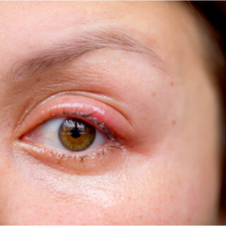 6. الجُدْد Spelled Stye