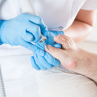 علاج فطريات أظافر القدم