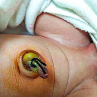 4. ظهور بعض البقع