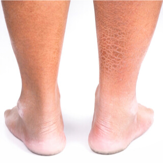 أمور تُسبب تفاقم الحالة