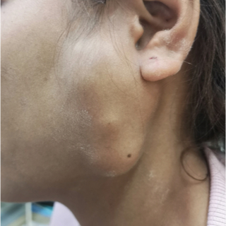 أسباب اضطرابات عصب الوجه