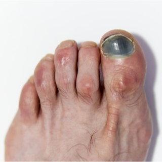 أظافر زرقاء