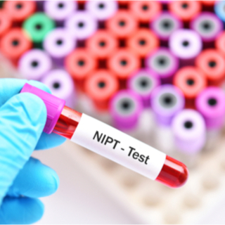 عوامل خطر الإصابة بمتلازمة داون وتشخيصها