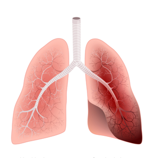 3. استعادة الرئئتين لوظيفتهما 3. استعادة الرئئتين لوظيفتهما