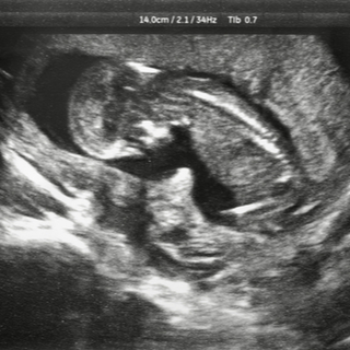 تطور الأعضاء الداخلية للجنين خلال الحمل في الشهر الثاني 