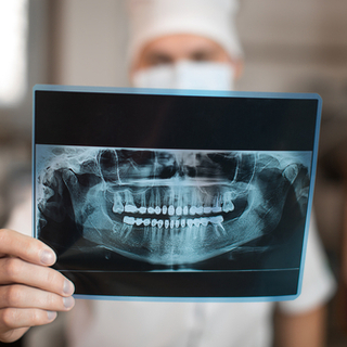 تشخيص أمراض اللثة بالصور