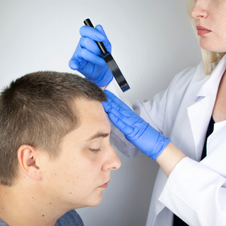  تشخيص داء الثعلبة