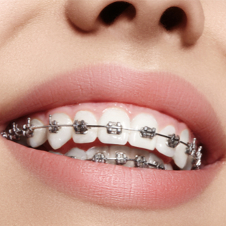 1. التقويم التقليدي