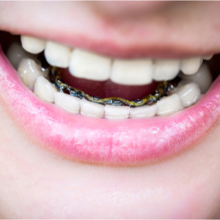 5. التقويم اللساني 