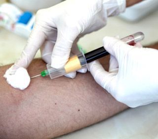 الفحص الدوري