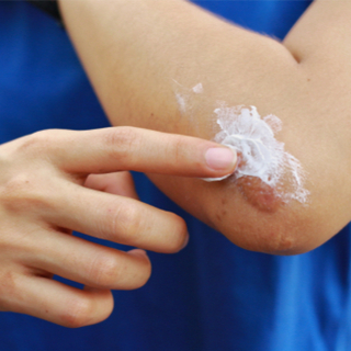 استخدم المضاد الحيوي