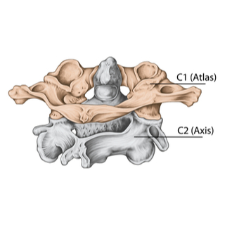الفقرات العنقية اللا نمطية