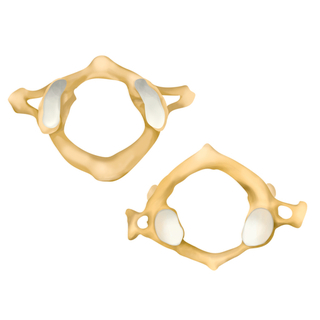 تركيب الفقرات العنقية اللا نمطية 